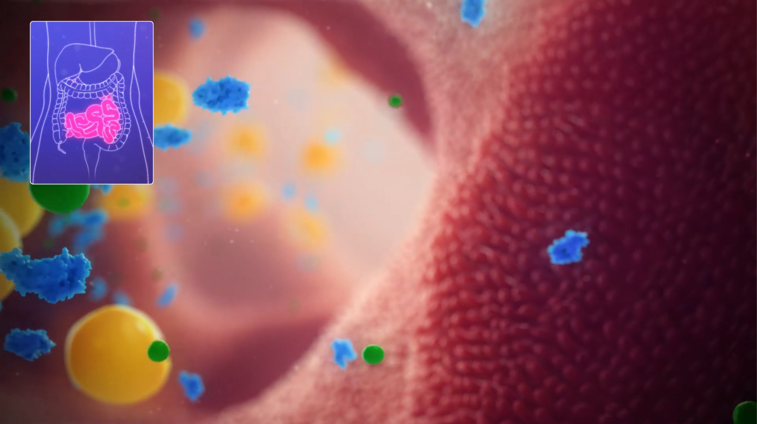 Video explaining how Short Bowel Syndrome (SBS) can affect how your body absorbs fats from food